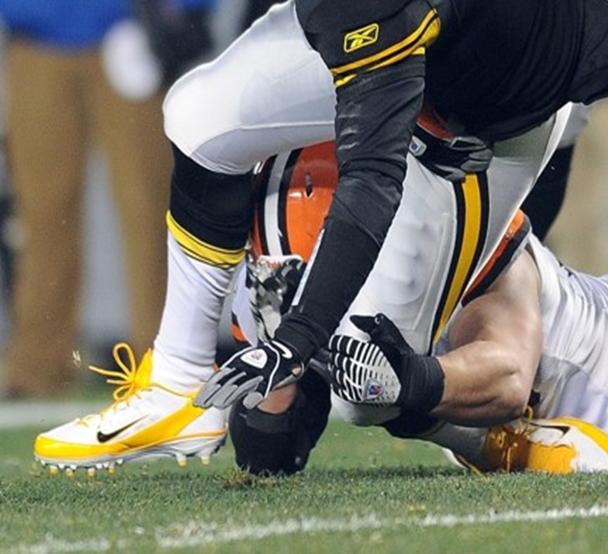 High Ankle Sprain & Syndesmosis Injury Foot & Ankle Orthobullets